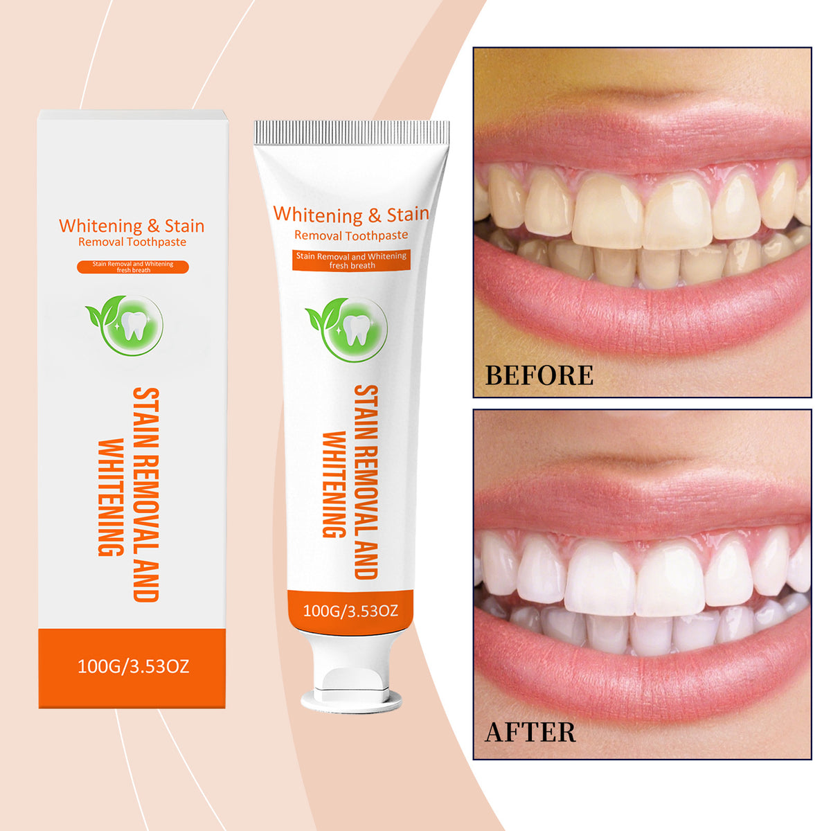 Gentle Whitening Toothpaste 100g