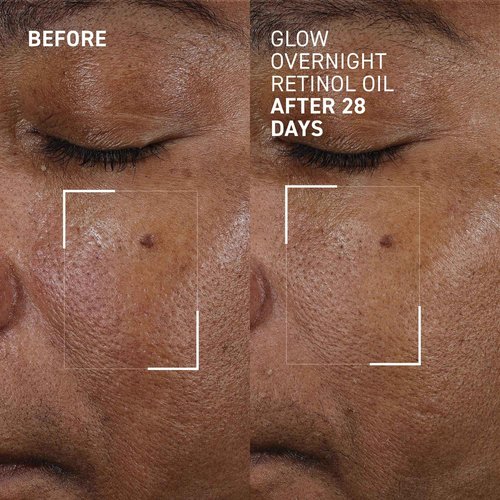 Dr. Brandt Bright This Way Glow Overnight Retinol Oil - Pure 2% Retinol Improves Wrinkles, Lines & Skin Texture - 1 fl oz