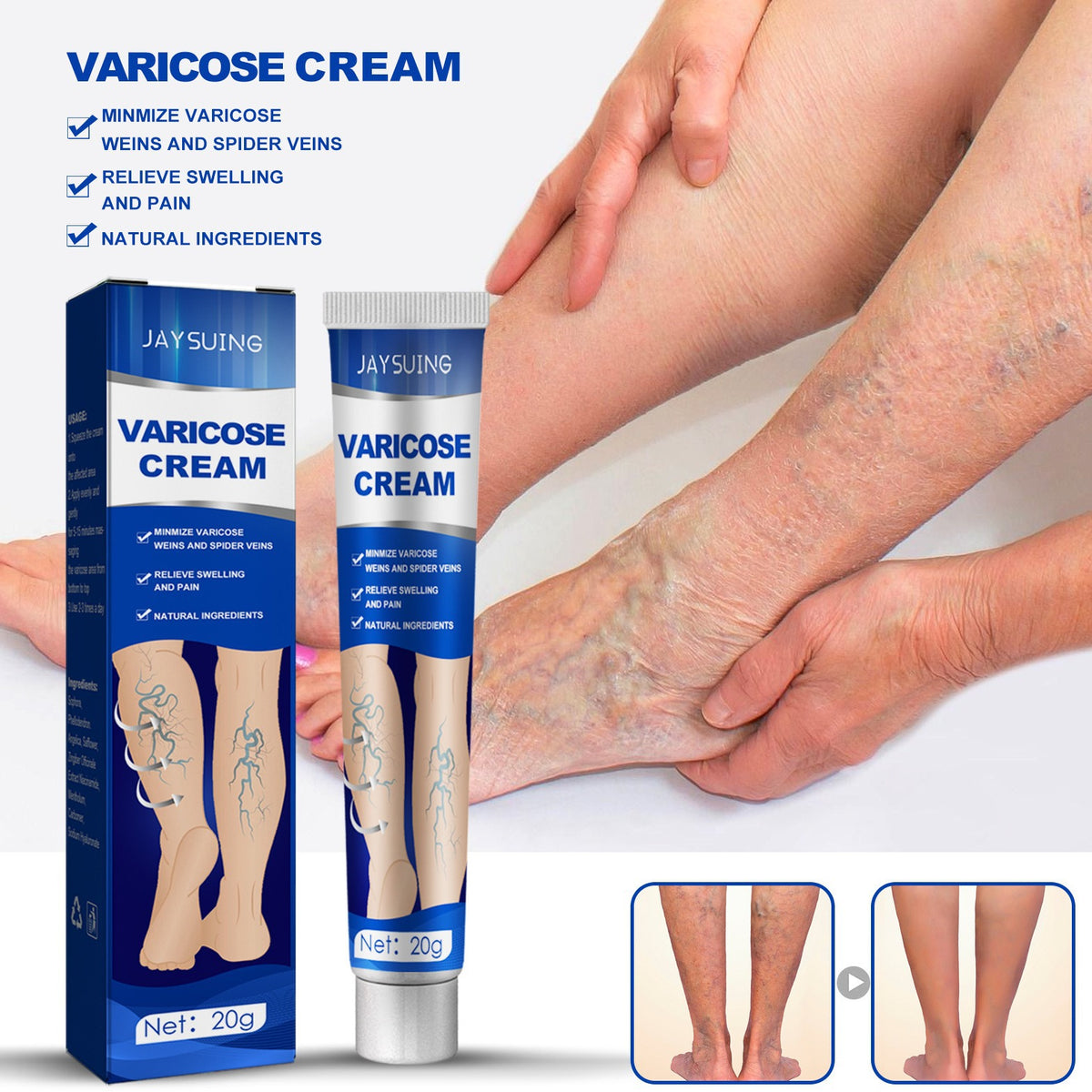 Leg Venous Support Cream for Discomfort Relief 20g - Body Care