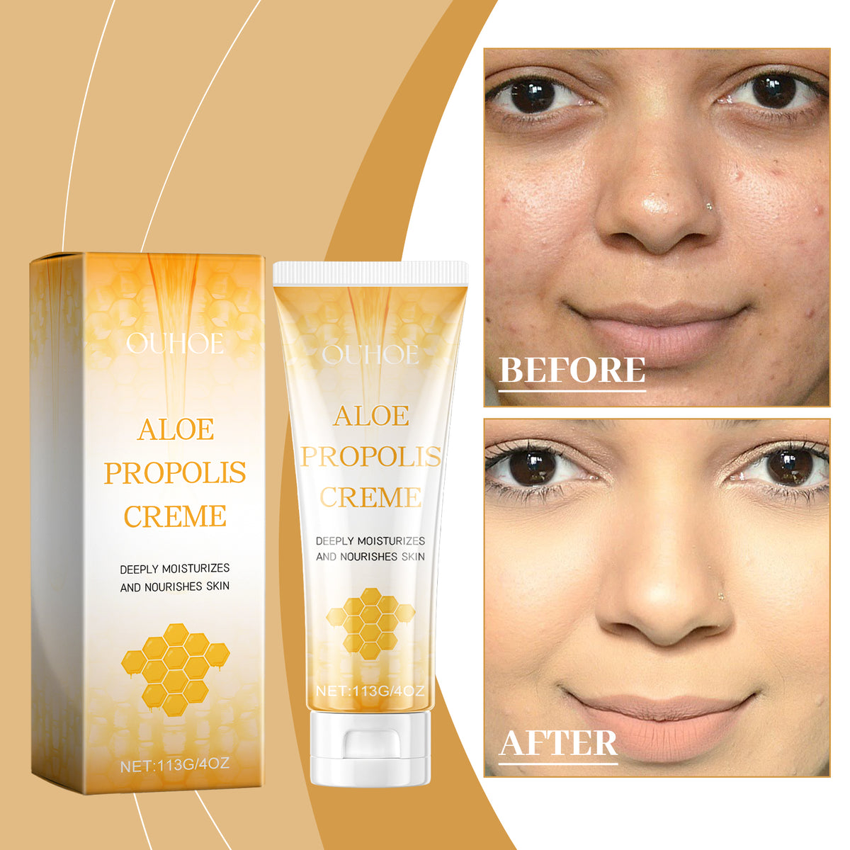 Aloe Propolis Moisturizing Cream 113g