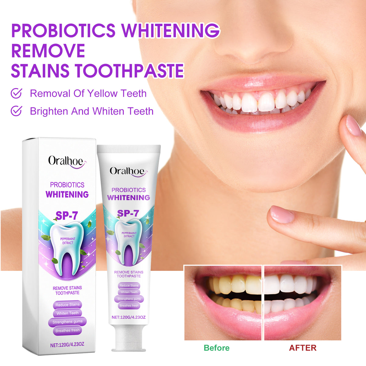 Probiotic Whitening Toothpaste 120g
