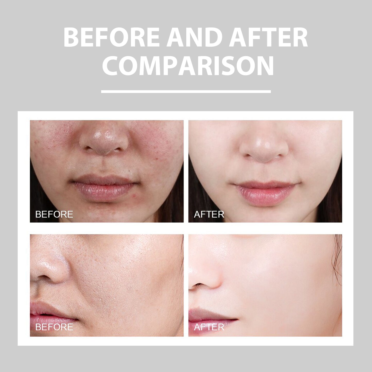 Hydrating Facial Moisturizer with Niacinamide & Hyaluronic Acid