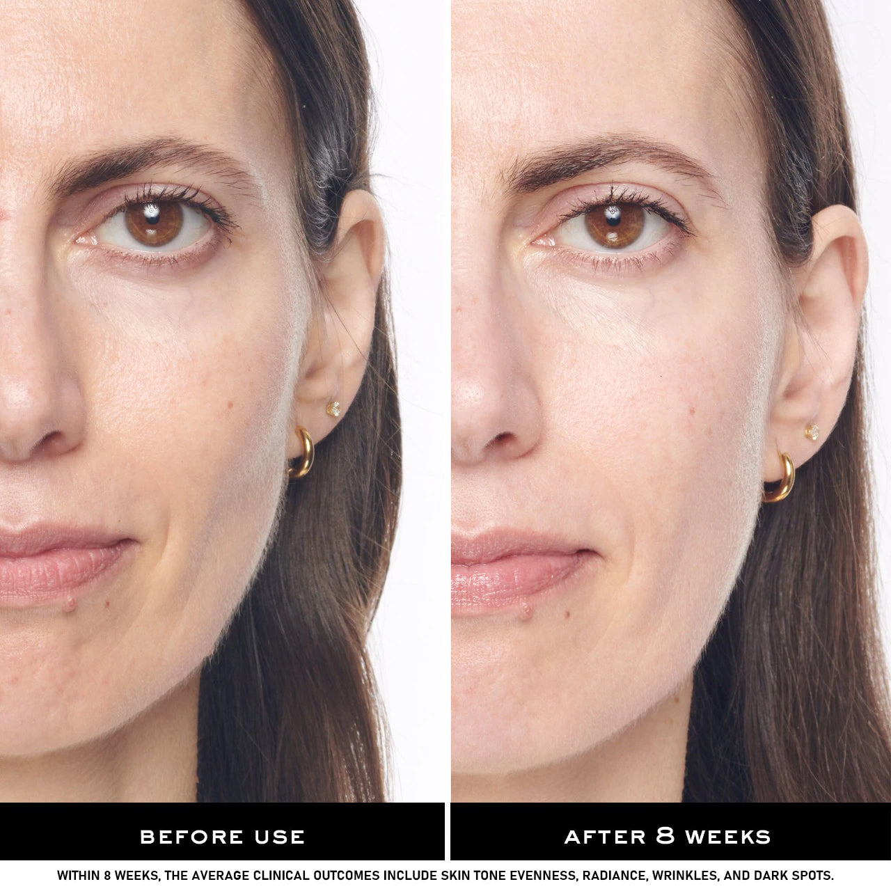 Bikini Area Skin Brightening Cream - Moisturizing Body Whitening Treatment