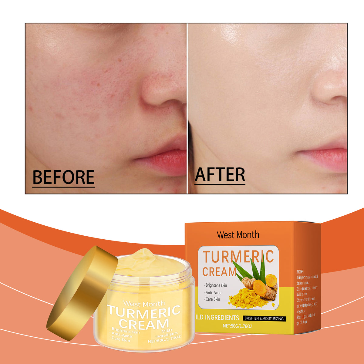 Turmeric Moisturizing Body Cream - Brightens Skin & Fights Acne 50g