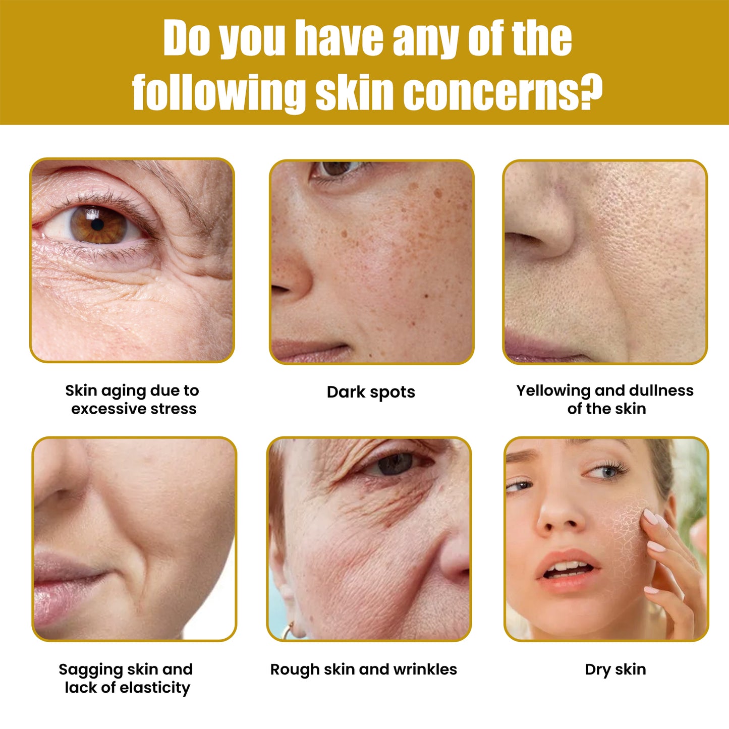 Bee Venom Anti-Aging Face Cream - Hydrating & Firming Skin Moisturizer