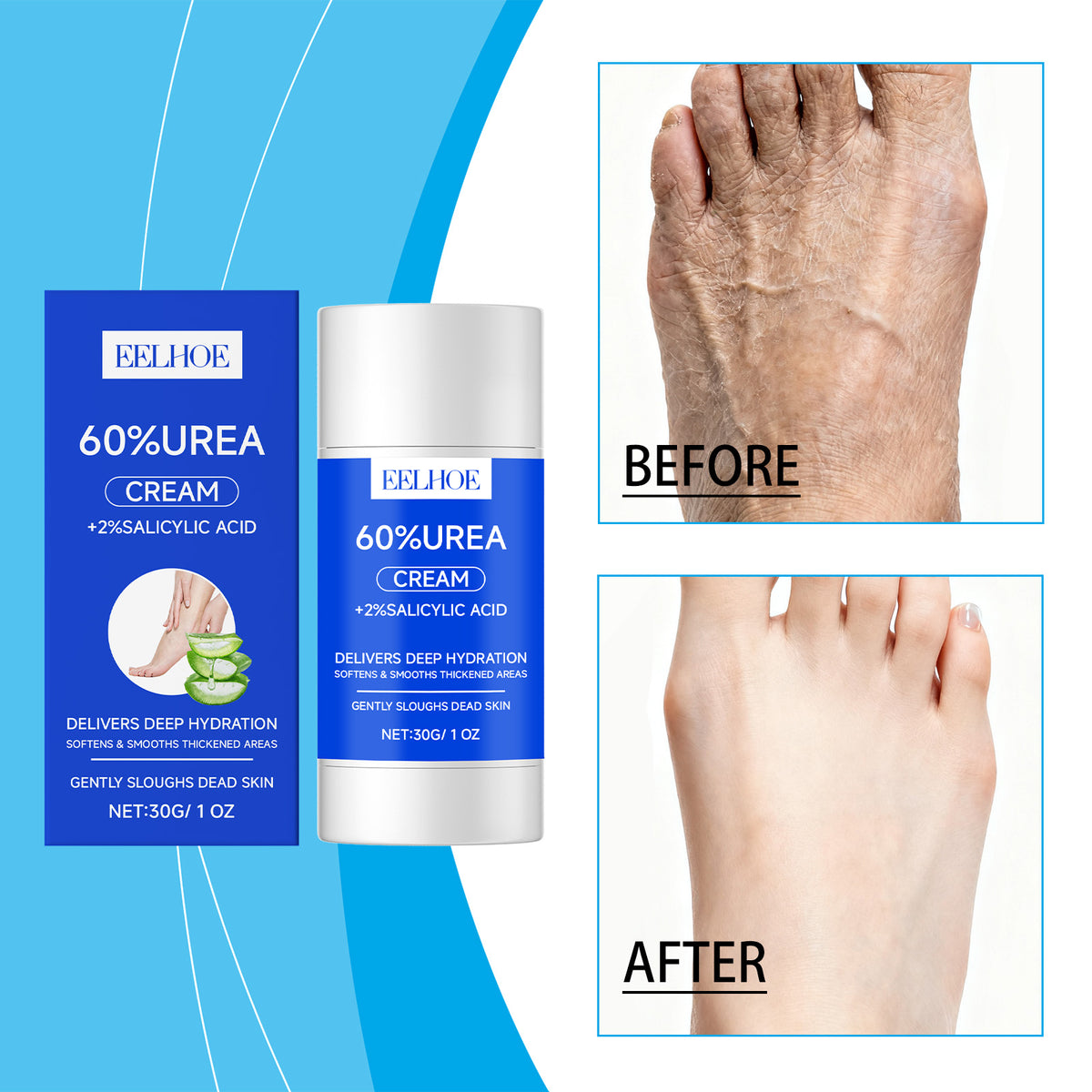 Urea Foot Care Stick 30g - Foot Soothing Balm for Cracked Skin