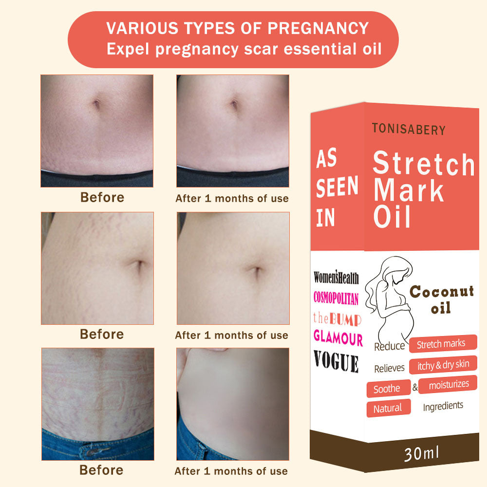 Mummy Oil 30ML Stretch Marks Body Oil - Skin Care Treatment for Ladies
