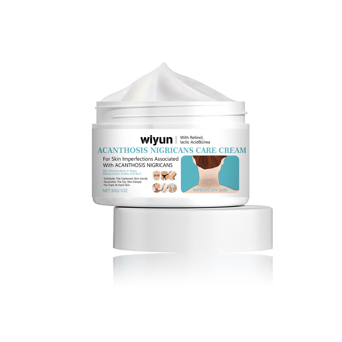 Acanthoderma Nigricans Care Cream - Hydrating Dark Spot Corrector