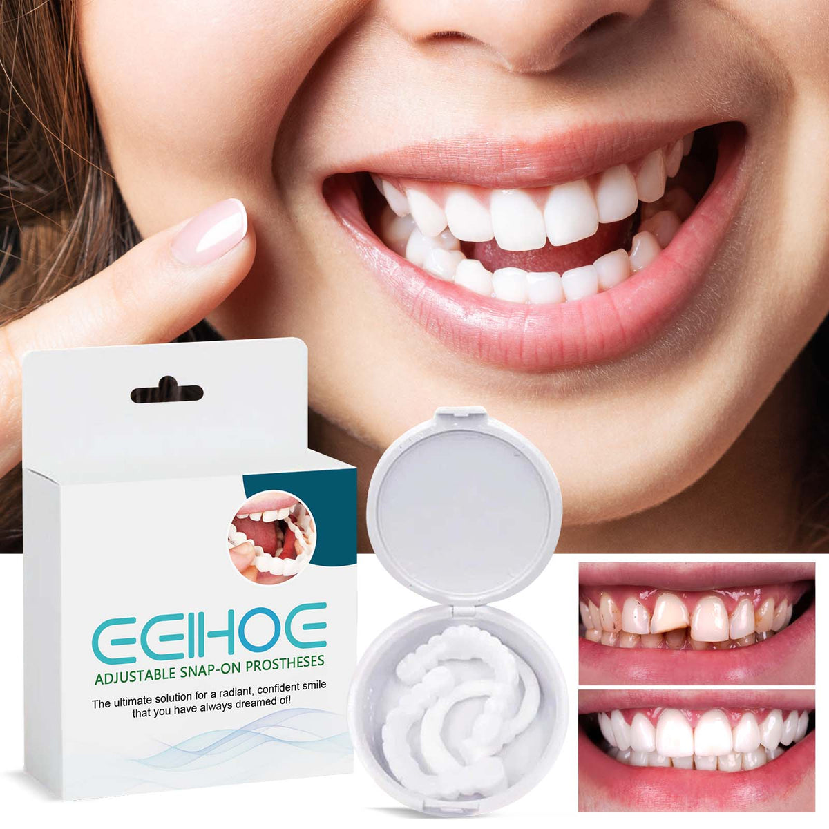 Adjustable Snap-On False Teeth - Resin Veneers