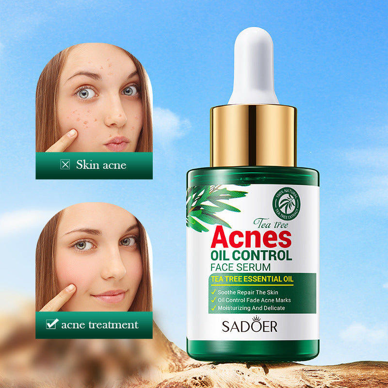 Tea Tree Hydrating Acne Control Facial Essence - 30ml