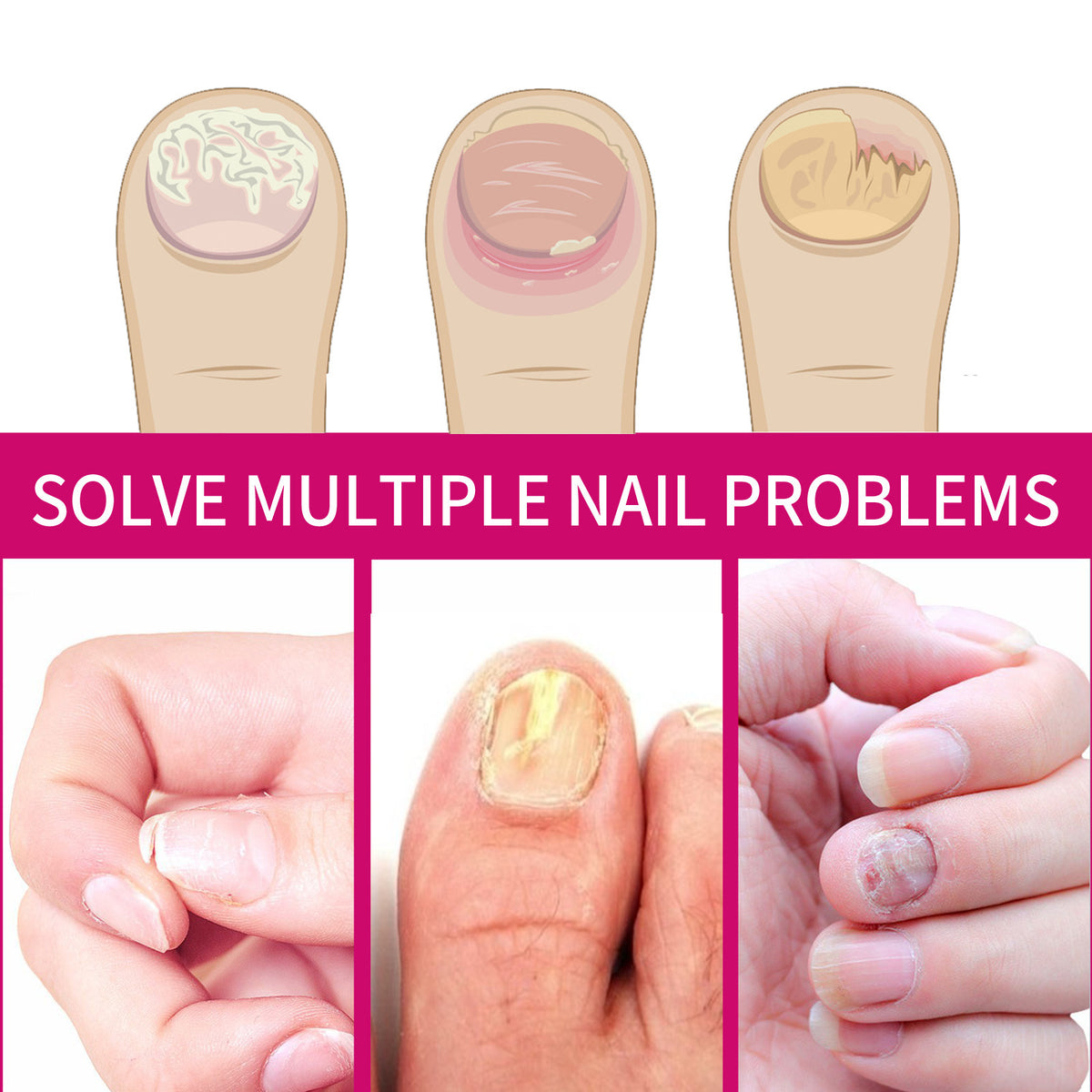 Nail Care Ginger Essence - Moisturizing Nail Treatment 10ml