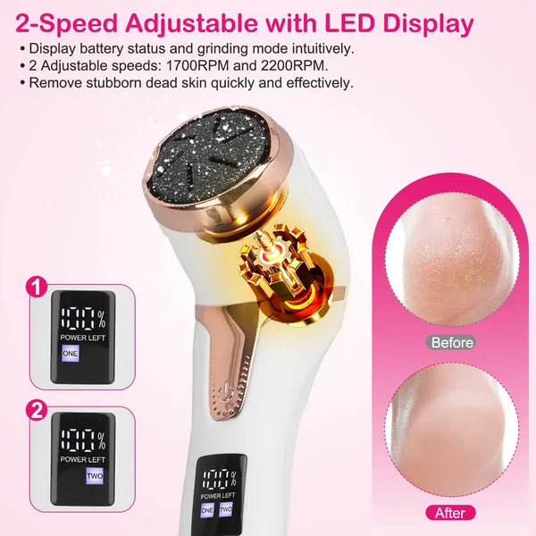 17-Piece Electric Foot Callus Remover Kit with Vacuum and 3 Grinding Heads