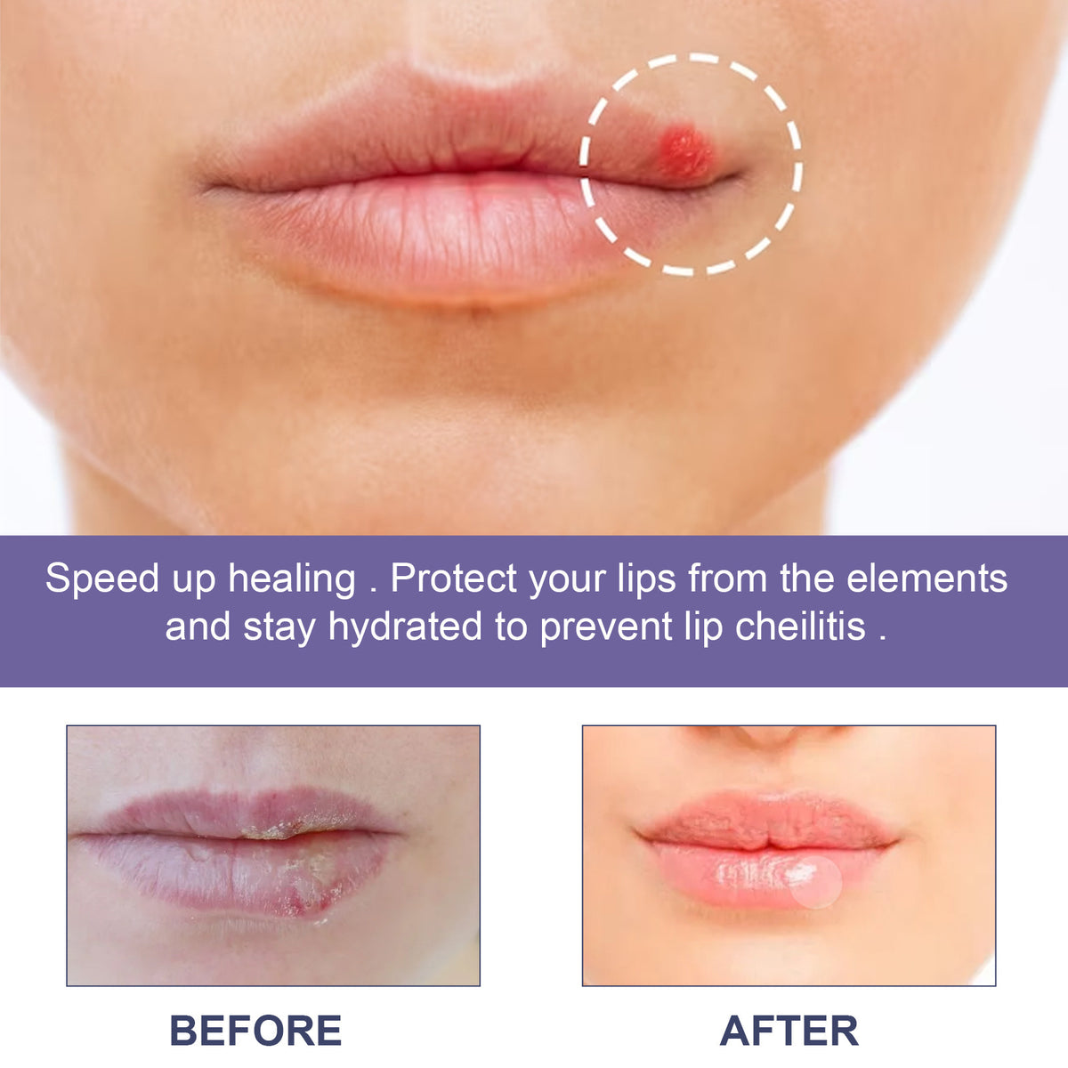 Moisturizing Lip Care Patch - 36pcs