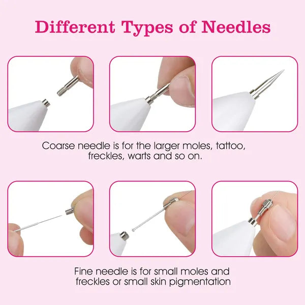 Portable Skin Tag Repair Kit - 9-Level Adjustable Electric Mole Remover