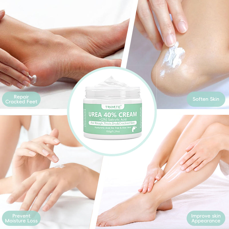 Hand and Foot Urea Cream 150g