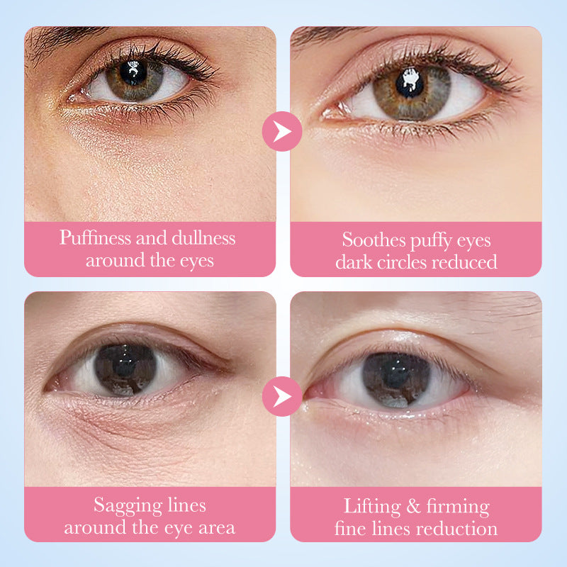 Collagen Replenishment Eye Mask - Hydrating Under Eye Patches for Skin Care