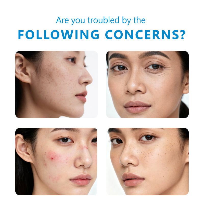 Anti-Acne Treatment Gel with Salicylic Acid - Fades Marks & Minimizes Pores