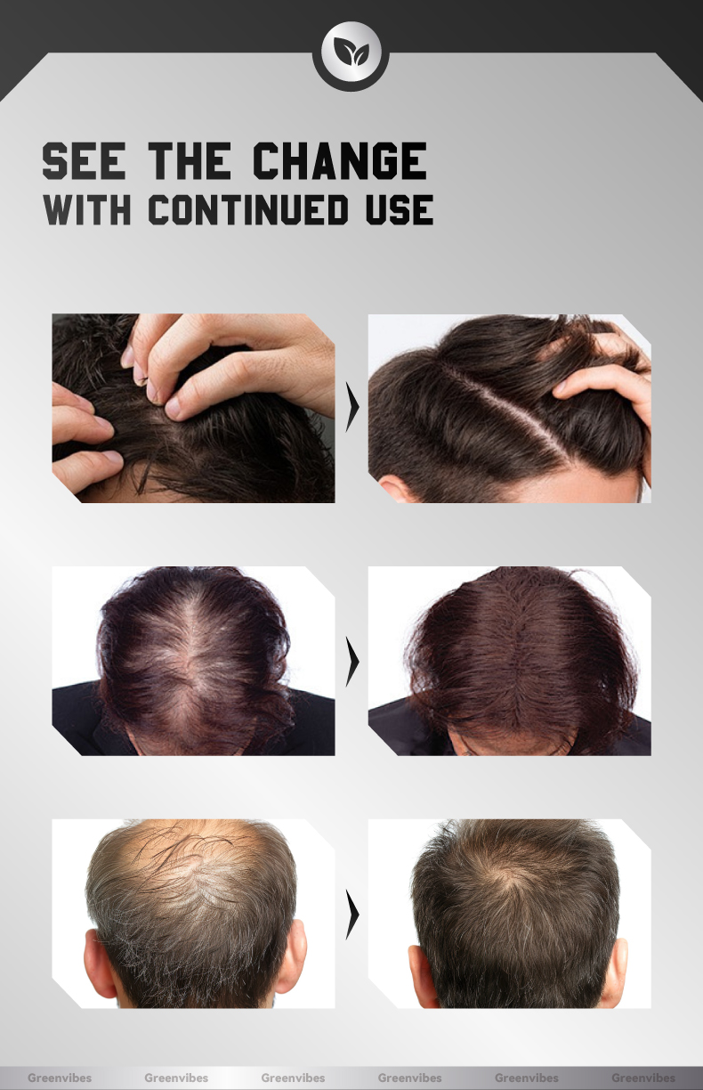 Anti-Breakage Hair Nourishing Essence for Dry and Frizzy Hair
