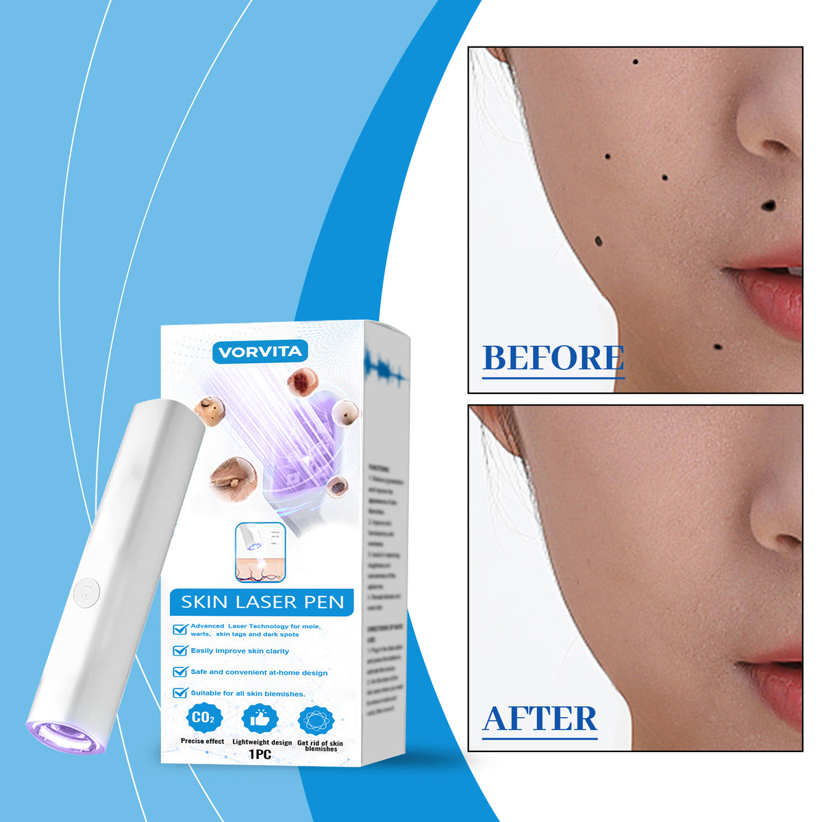 Skin Laser Pen Body Care Tool