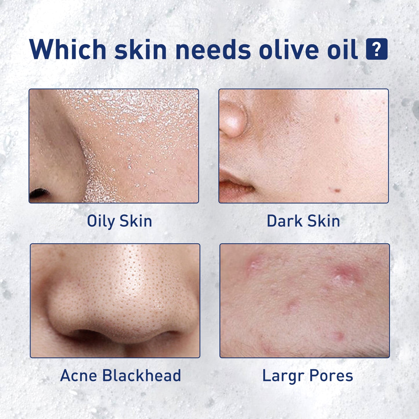 Exfoliating Facial Mousse - Deep Pore Cleansing & Oil Control Foam