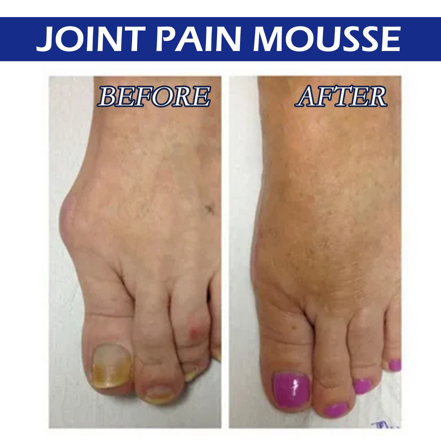 Herbal Body Care Solution for Soreness Relief and Joint Massage - 15ml