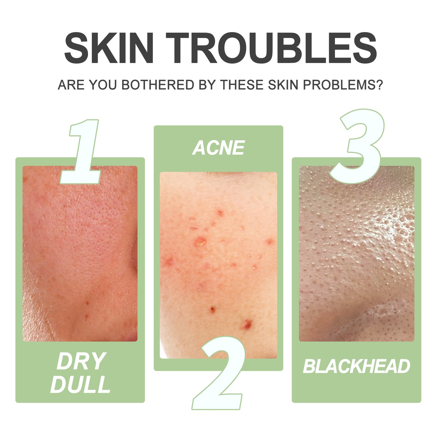 Hydroxy Acid Facial Exfoliating Gel - Deep Pore Cleansing & Skin Brightening