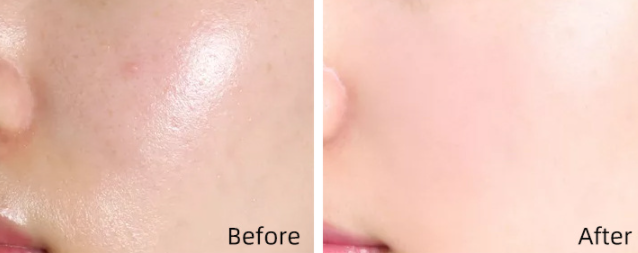 Full Coverage Concealer for Blemishes Dark Circles & Tattoos - 14g