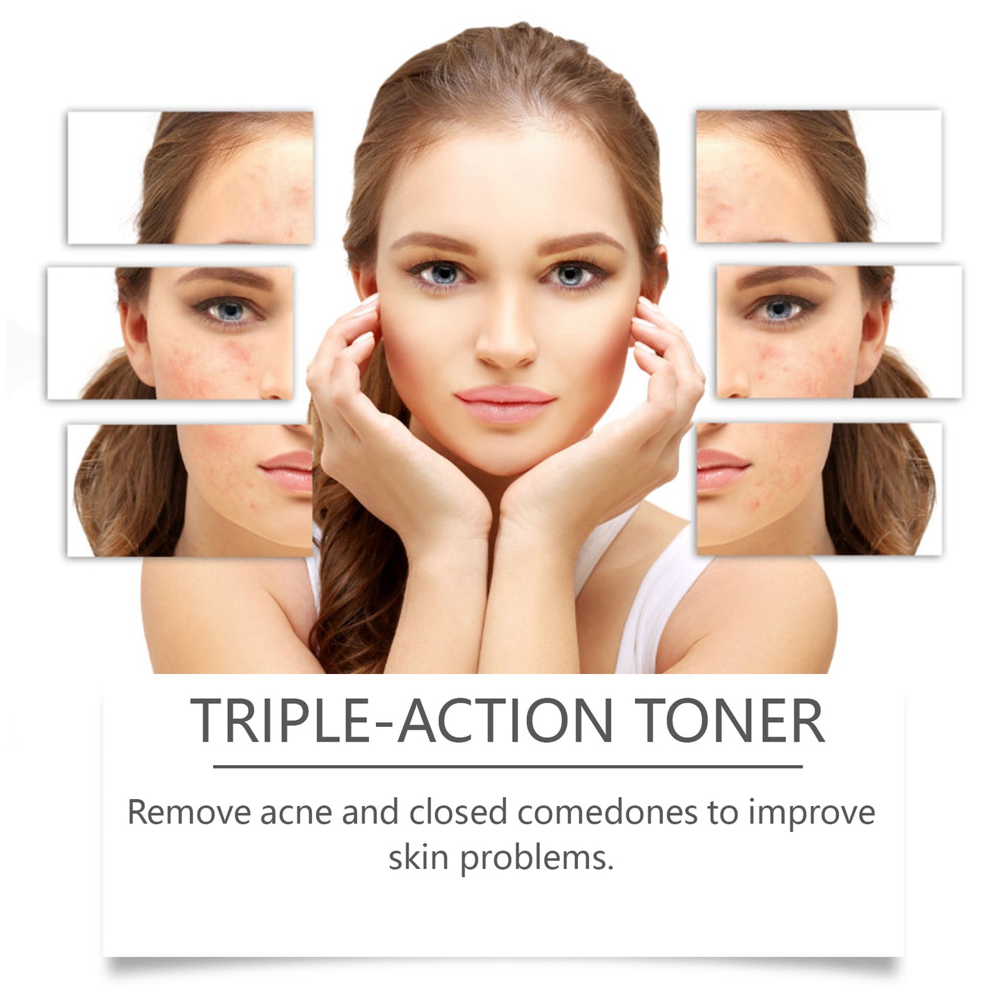 Facial Toner with Green Tea & Hyaluronic Acid - 100ml Acne Care