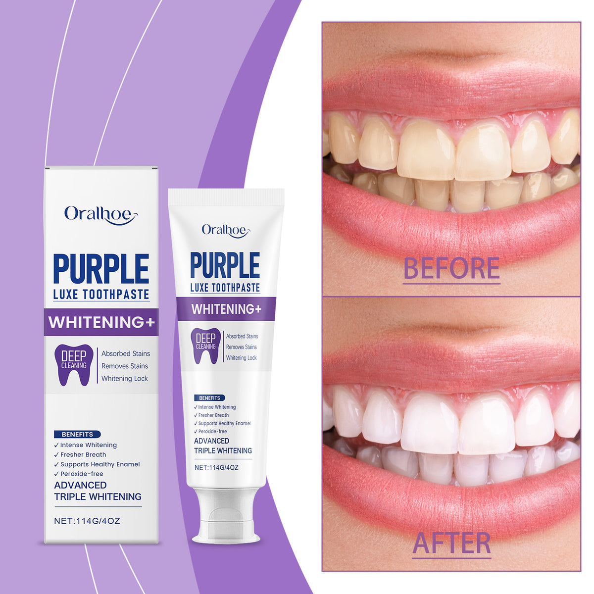 Whitening Toothpaste 114g - Brightening & Breath Fresh