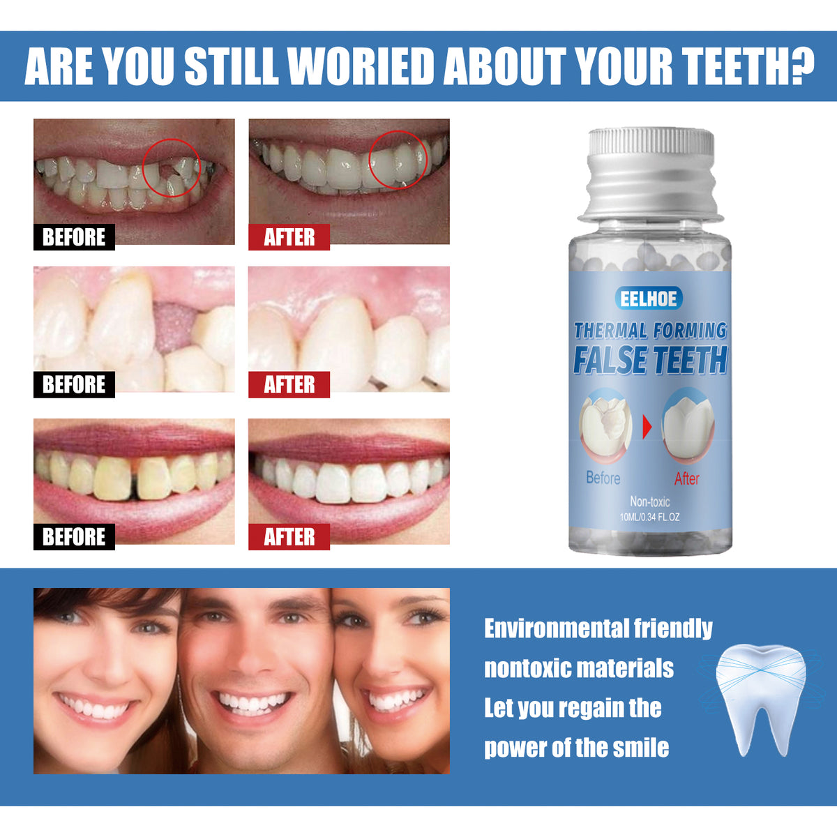 Moldable Dental Putty - Temporary Tooth Filler 30ml