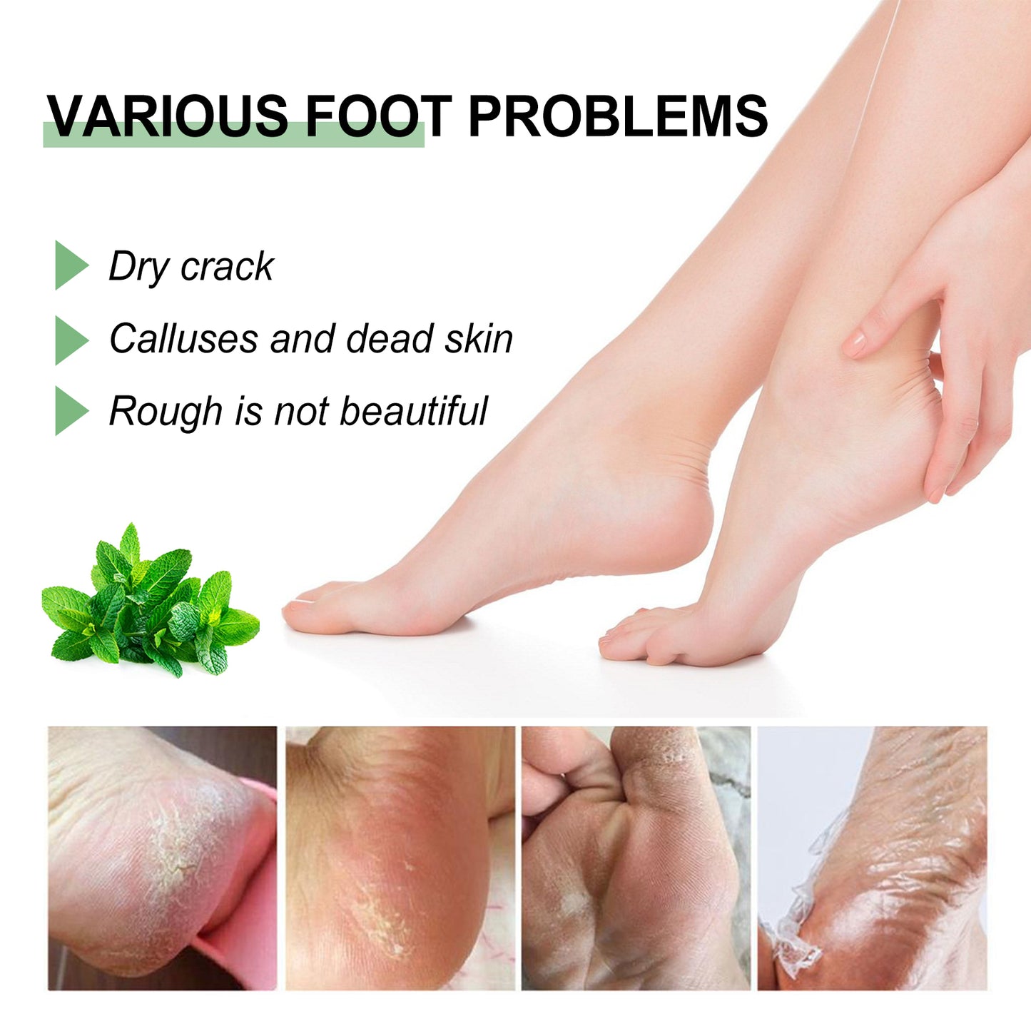 Peppermint Foot Cream for Cracked Heels - Moisturizing Foot Repair Balm