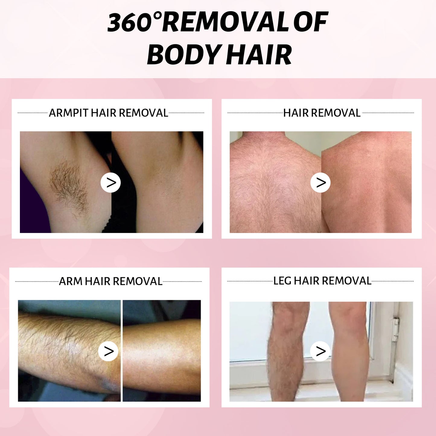 Gentle Hair Removal Spray Mousse for Face, Legs, Arms & Body
