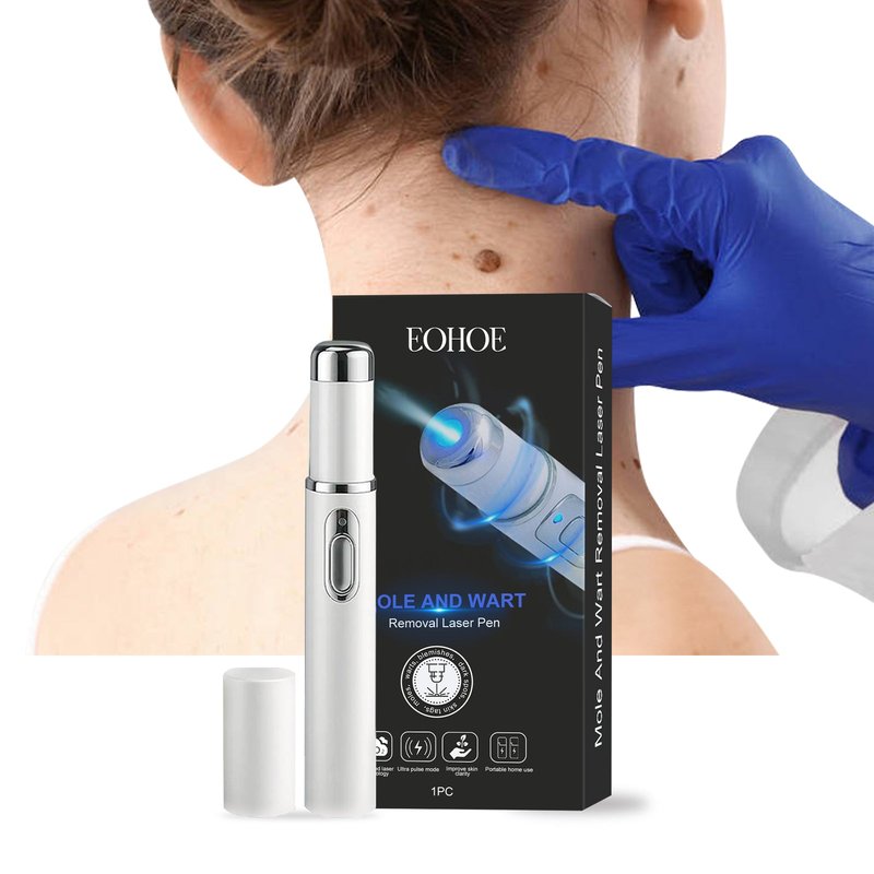 Skin Laser Pen for Face Skin Care - 1pc