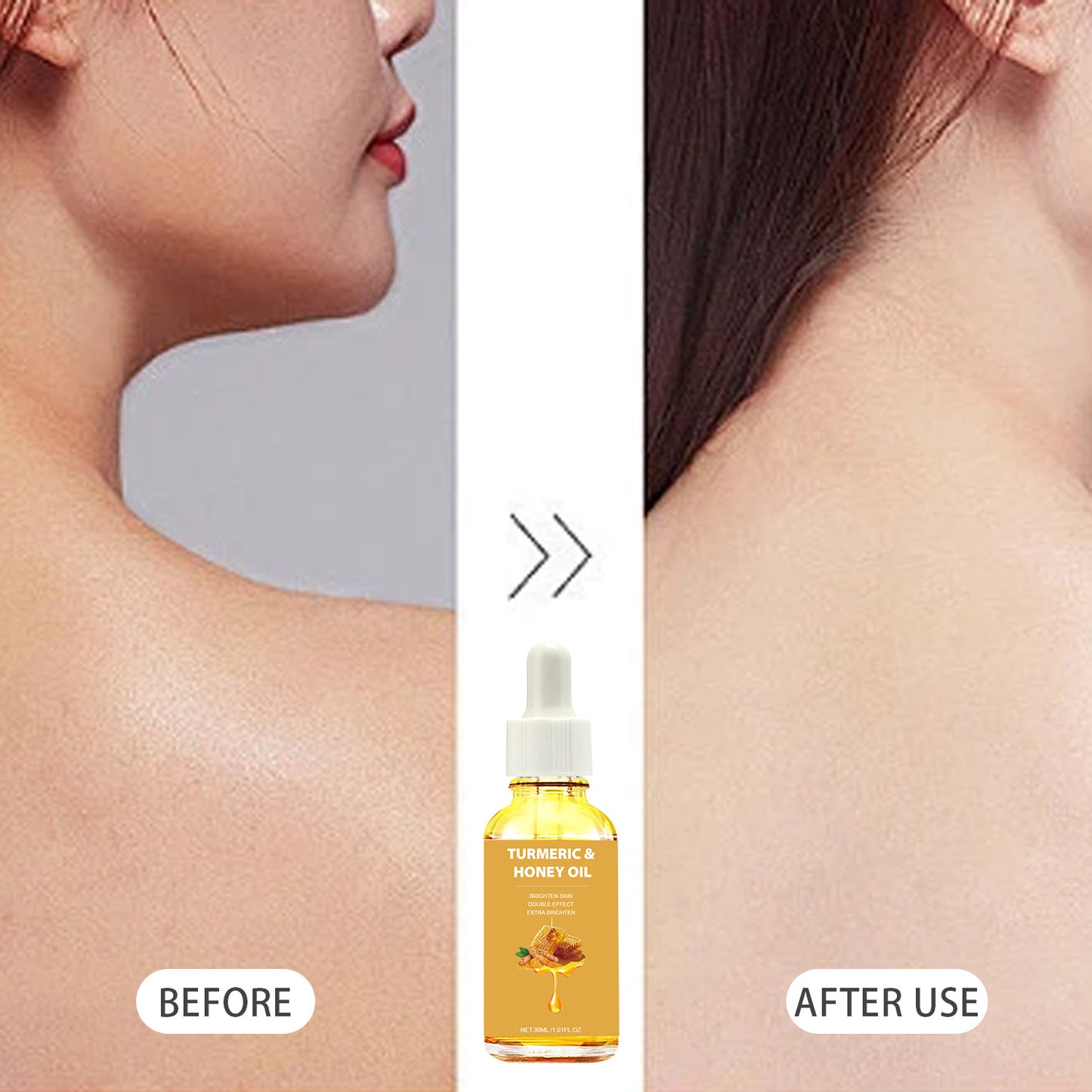 Turmeric Honey Essential Oil 30ml - Natural Skin Care Remedy