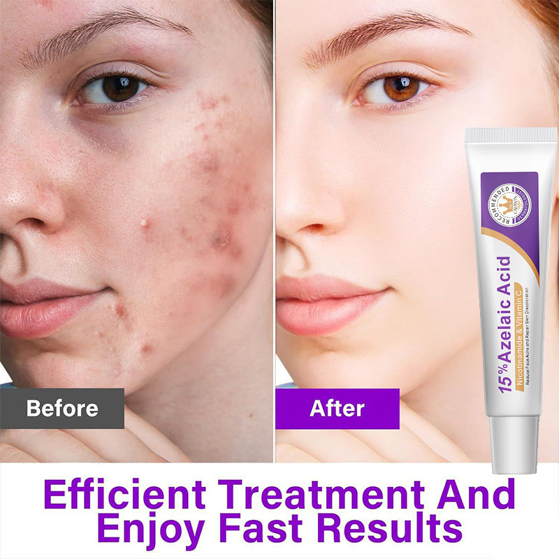 15% Azelaic Acid Essence 20g Skin Care Serum for Brightening & Acne