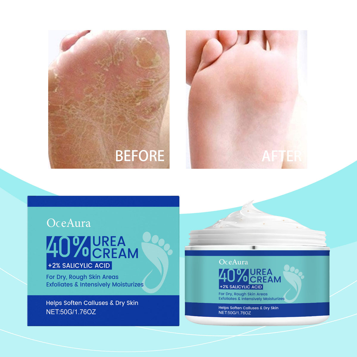 Urea Foot Cream 50g