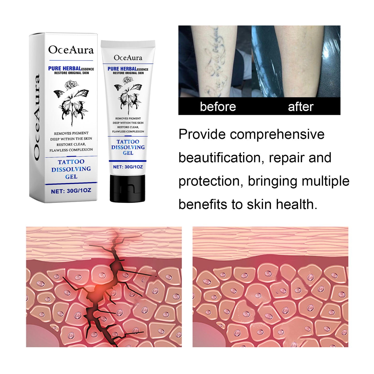 Tattoo Dissolving Gel - Skin Repair & Tattoo Brightening Cream