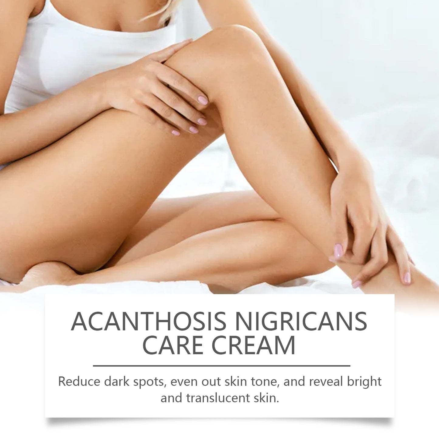 Acanthoderma Nigricans Care Cream - Hydrating Dark Spot Corrector