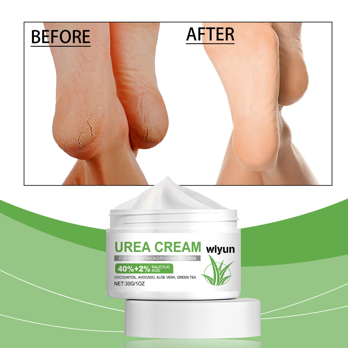 Foot Urea Care Cream - Moisturizing Foot Balm for Dry Skin 30g