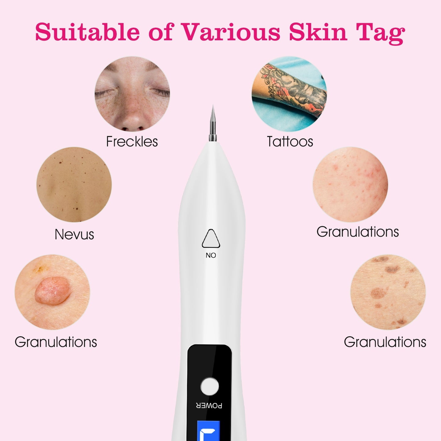2 PCS Skin Tag Repair Kit - 9-Level Adjustable LCD Beauty Tool with Needles