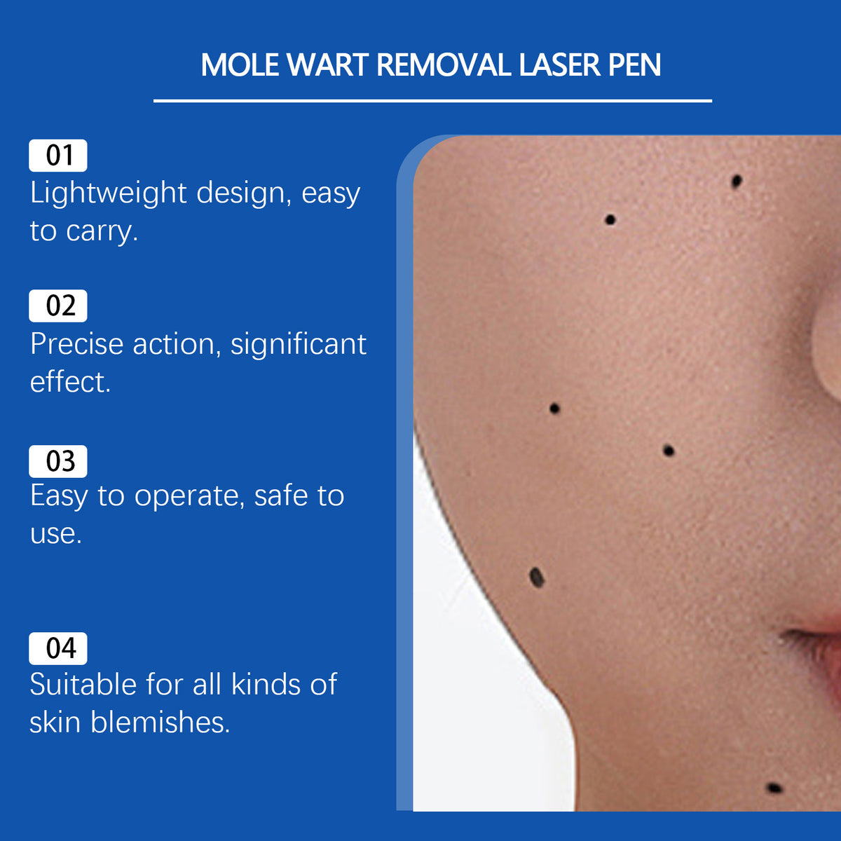 Mole Wart Removal Laser Pen