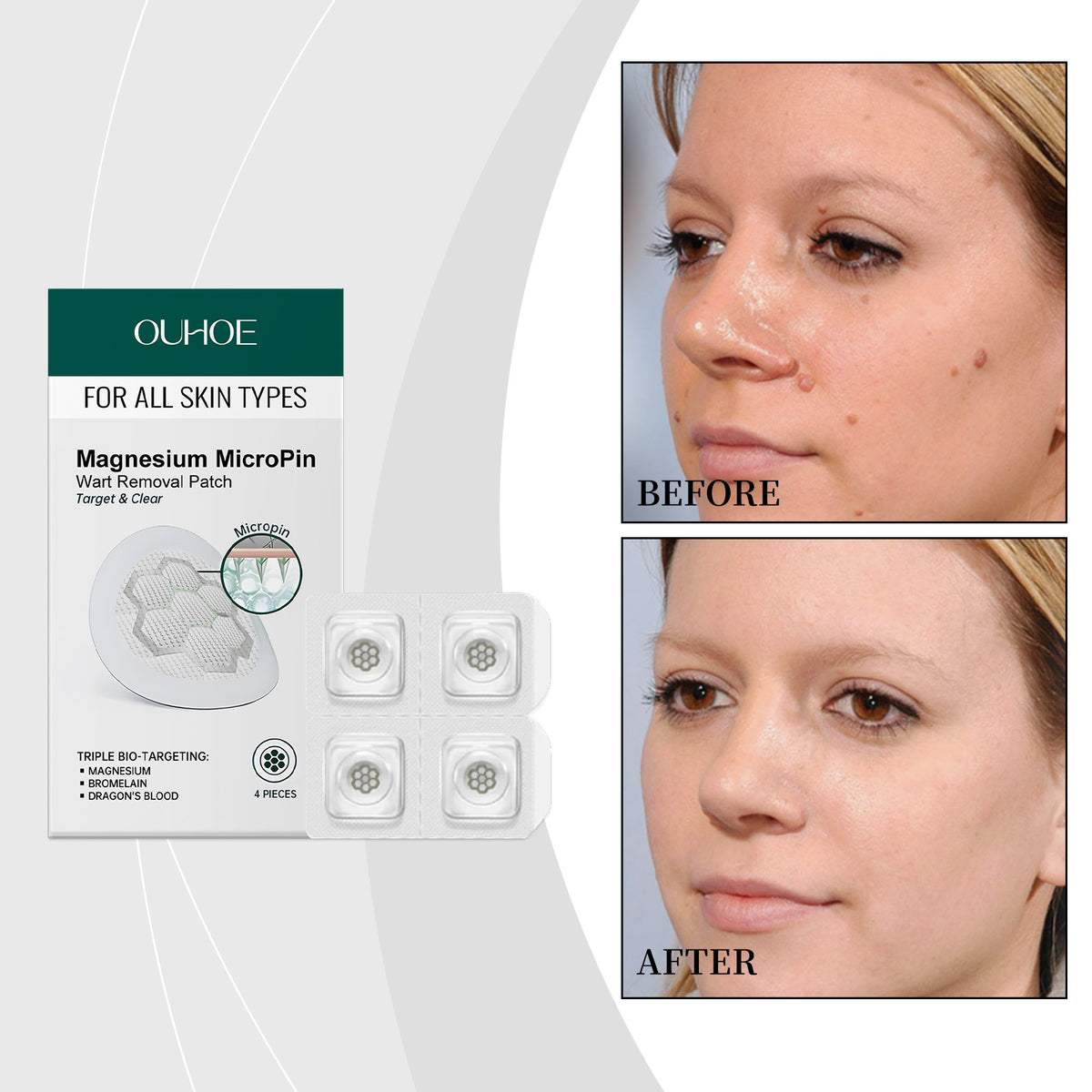 Skin Cleansing & Beauty Patches - 4pcs