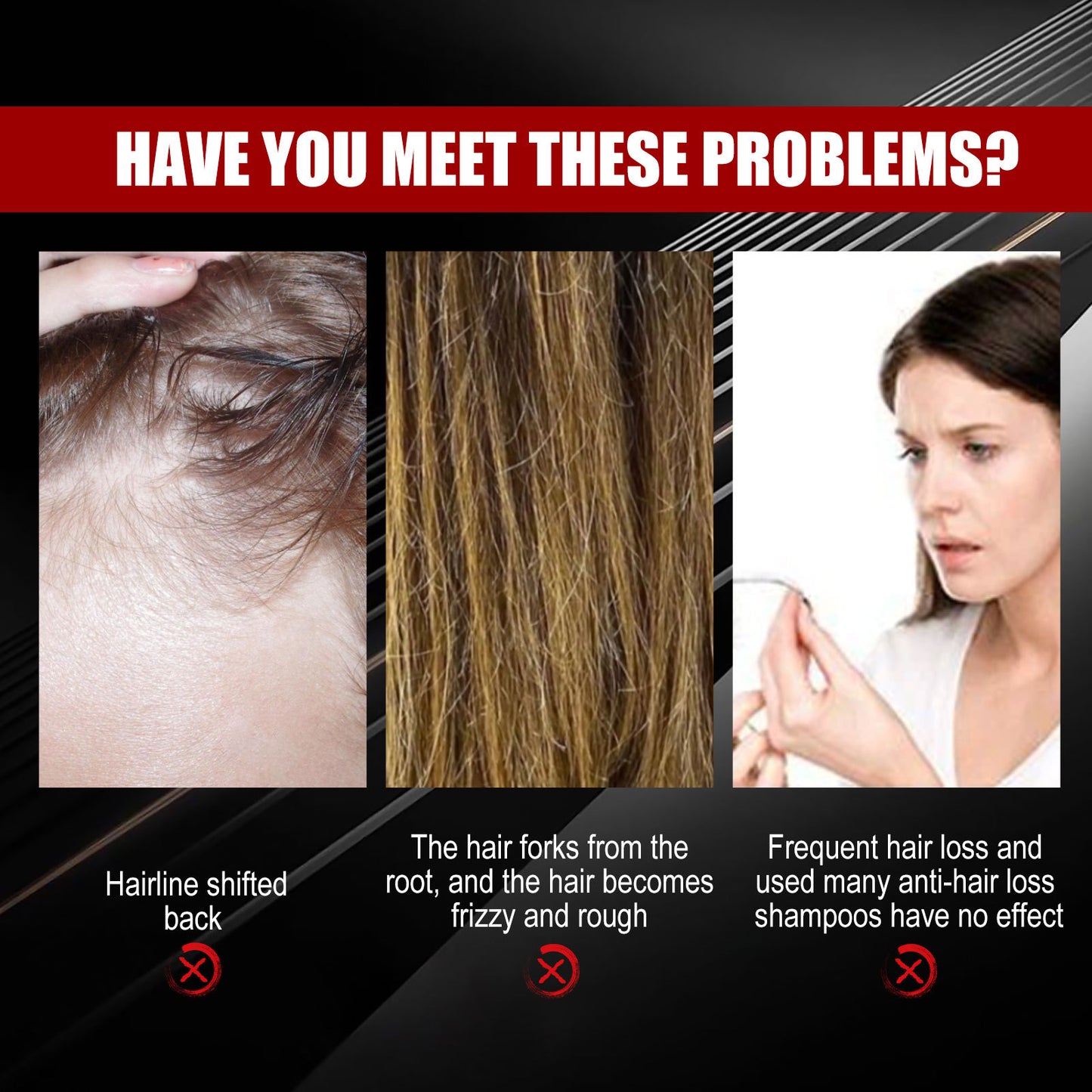 Black Rice Hair Growth Spray - Strengthening & Scalp Nourishing Treatment