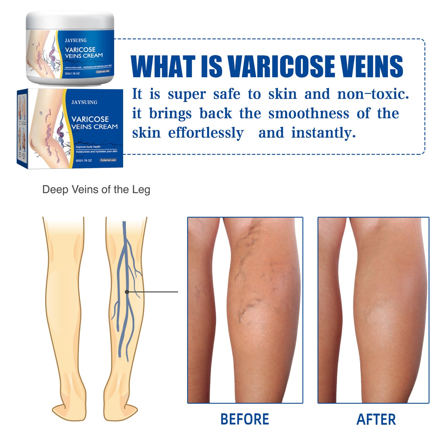 Leg Vein Repair Cream for Varicose Vein Relief and Massage