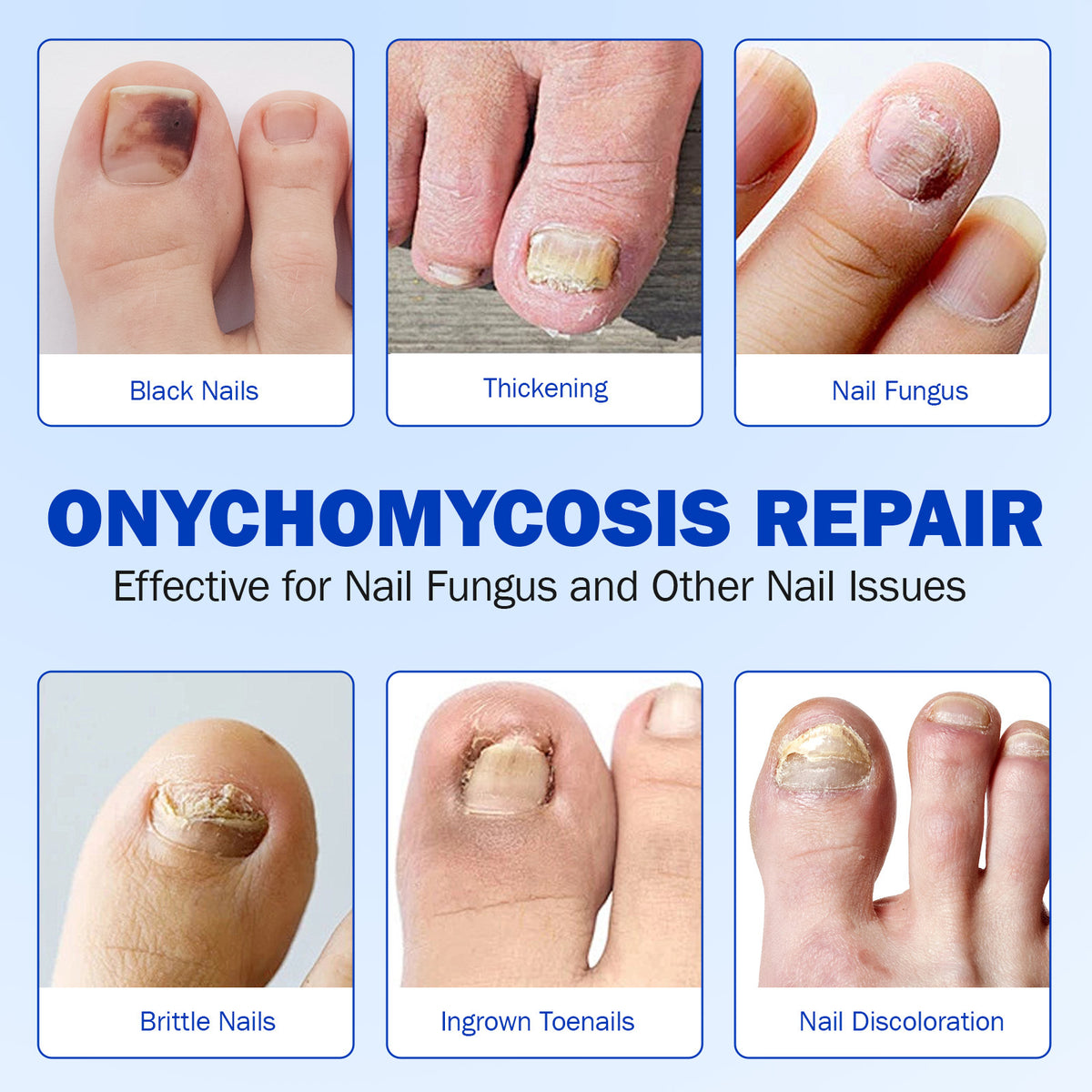 Nail Antibacterial Patch Strengthening Health