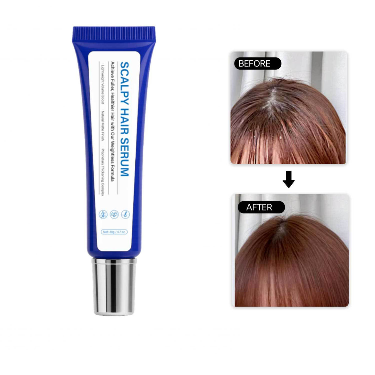 Scalp Hair Repair 20g Scalpy Serum