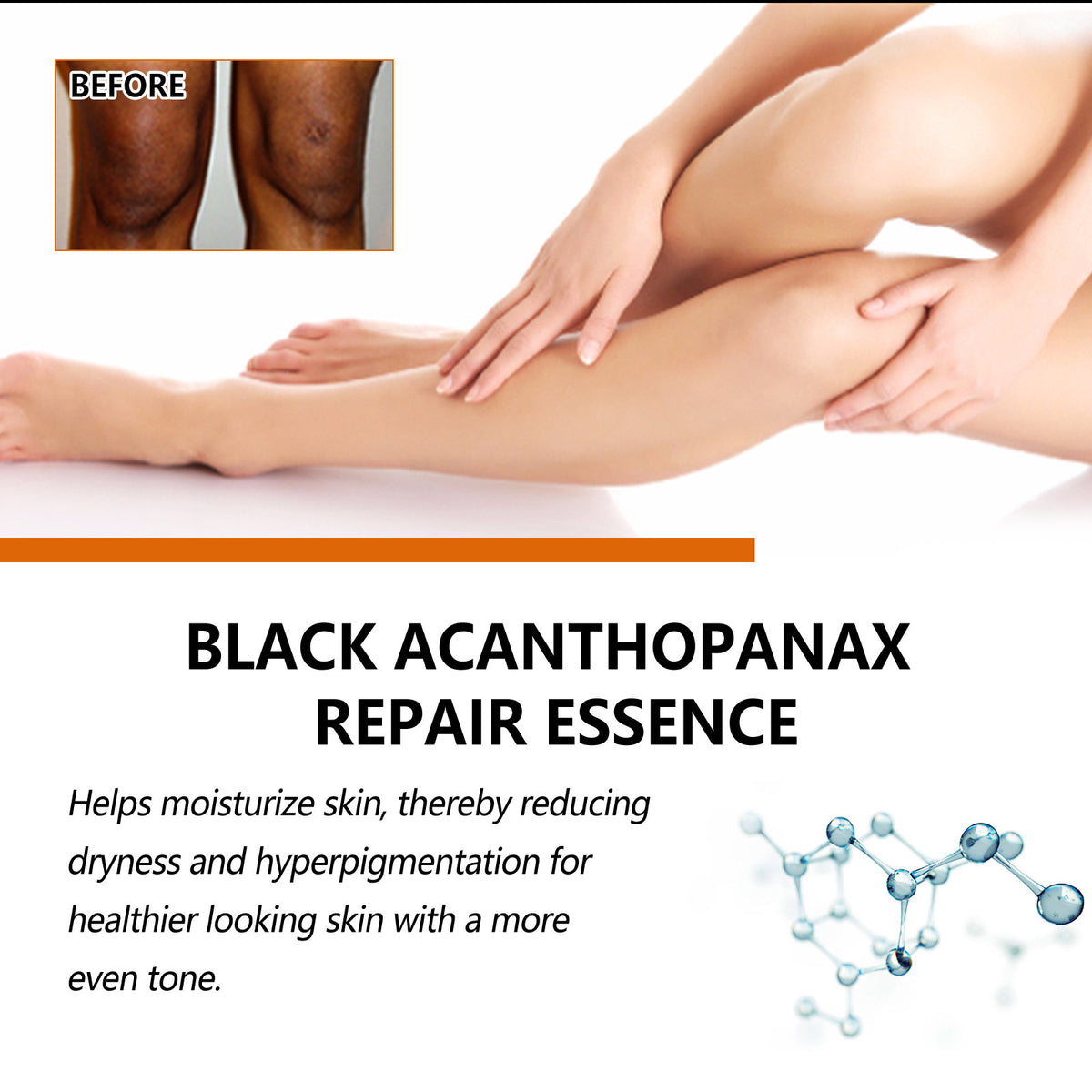 Black Ratchet Repair Joint Whitening Brightening