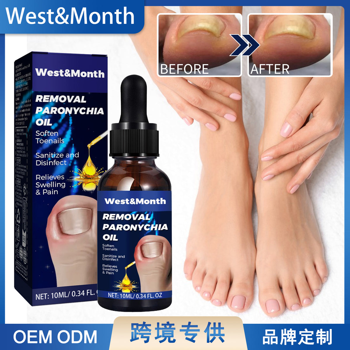 Nail Care Oil 10ml - Toenail & Cuticle Treatment