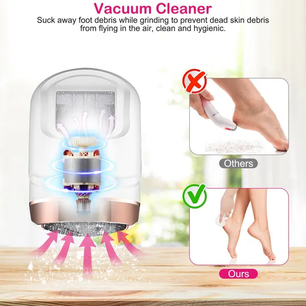 17-Piece Electric Foot Callus Remover Kit with Vacuum and 3 Grinding Heads