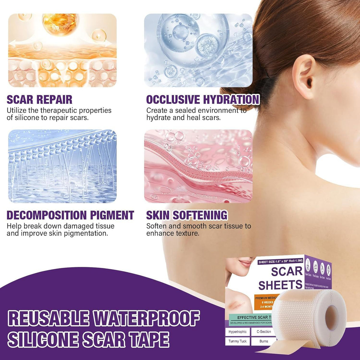 Scar Paster Silicone Sheets15 M Length Soothing
